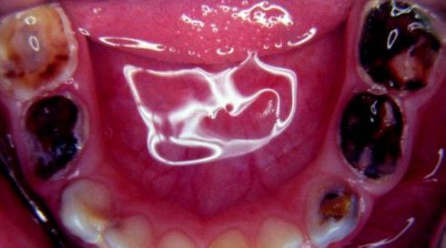 约会必备！嘉娜宝玫瑰香体糖，怎么吃才不伤牙？